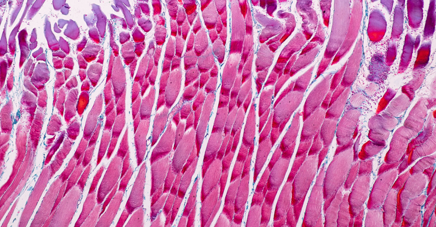 Education anatomy and Histological sample Striated (Skeletal) muscle of mammal Tissue under the microscope.